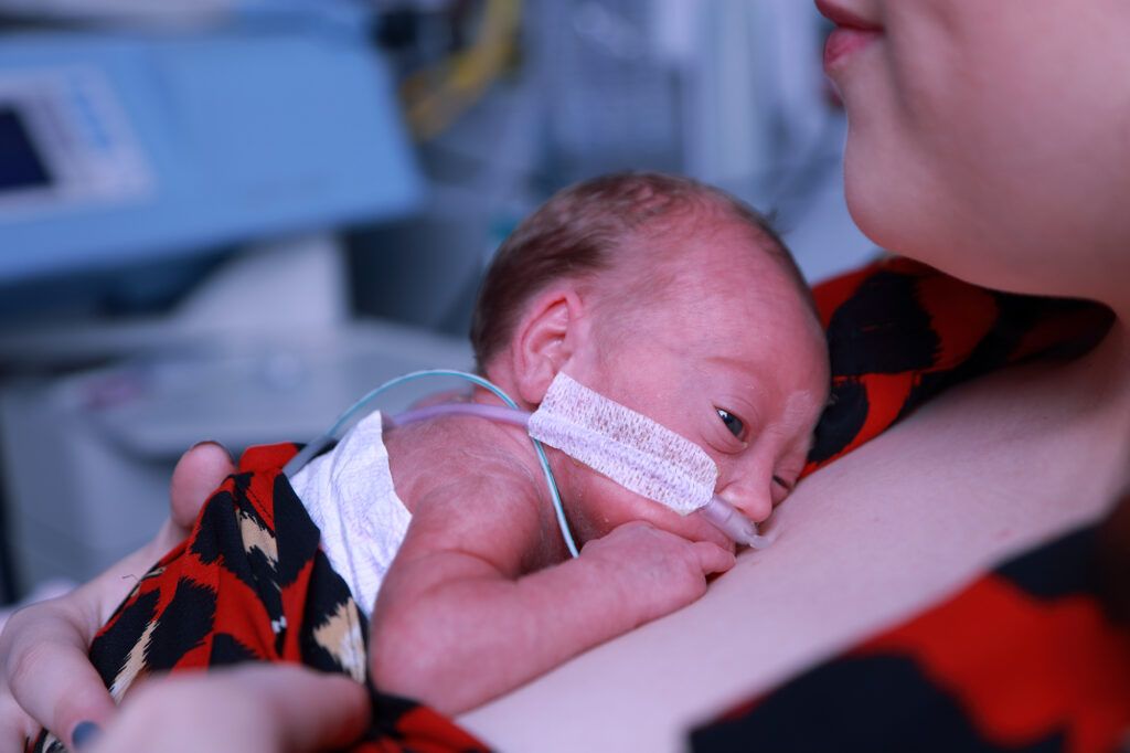 image of a premature baby at Tiny Lives Trust