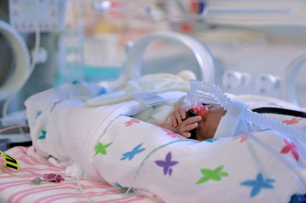 Image of a premature baby in an incubator at Tiny Lives Trust