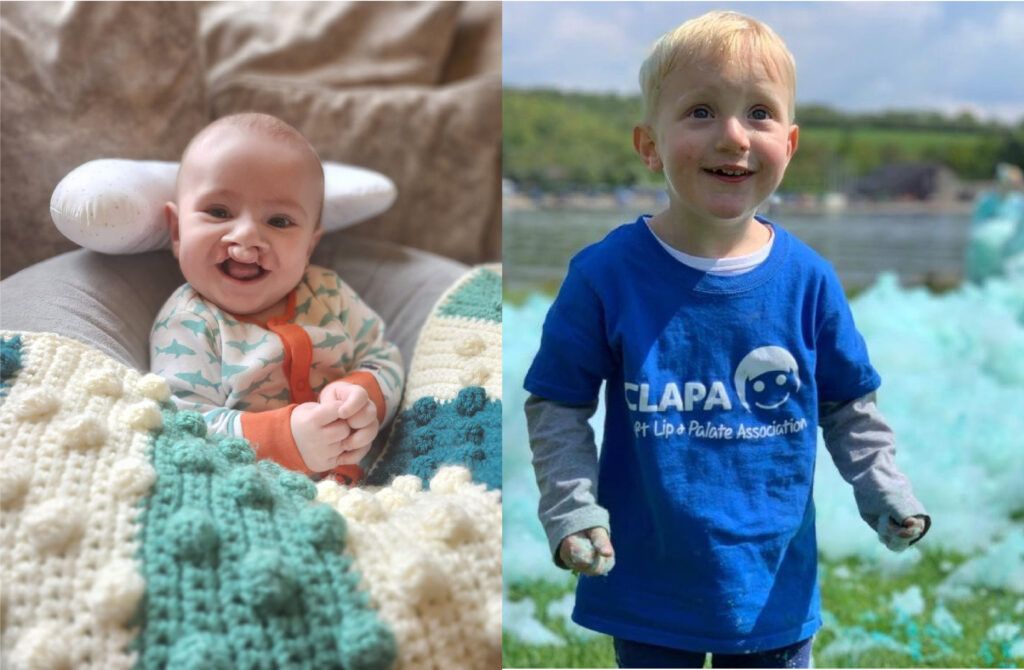 collage of a baby and a young child at CLAPA